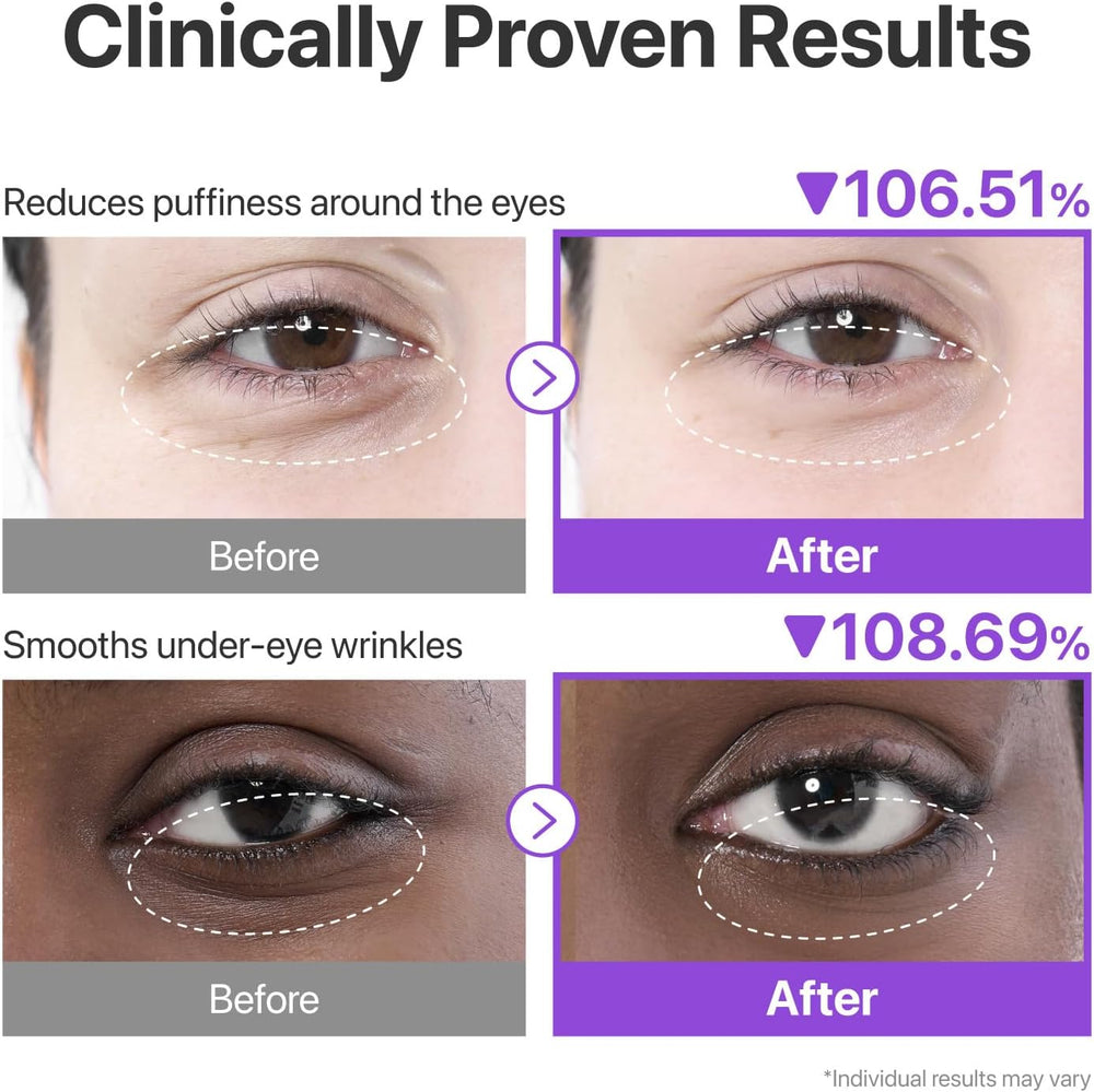 numbuzin No.9 NAD+ Collagen Under Eye Patches (5 Pairs)