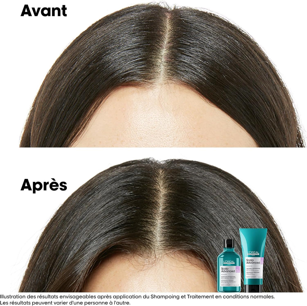 L'Oréal Professionnel Scalp Advanced Anti-Discomfort Shampoo 500ml – image 3