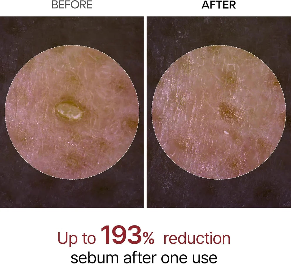 Before and after comparison of a skin pore under magnification, showing a sebum reduction claim with text reading 'Up to 193% reduction sebum after one use'.