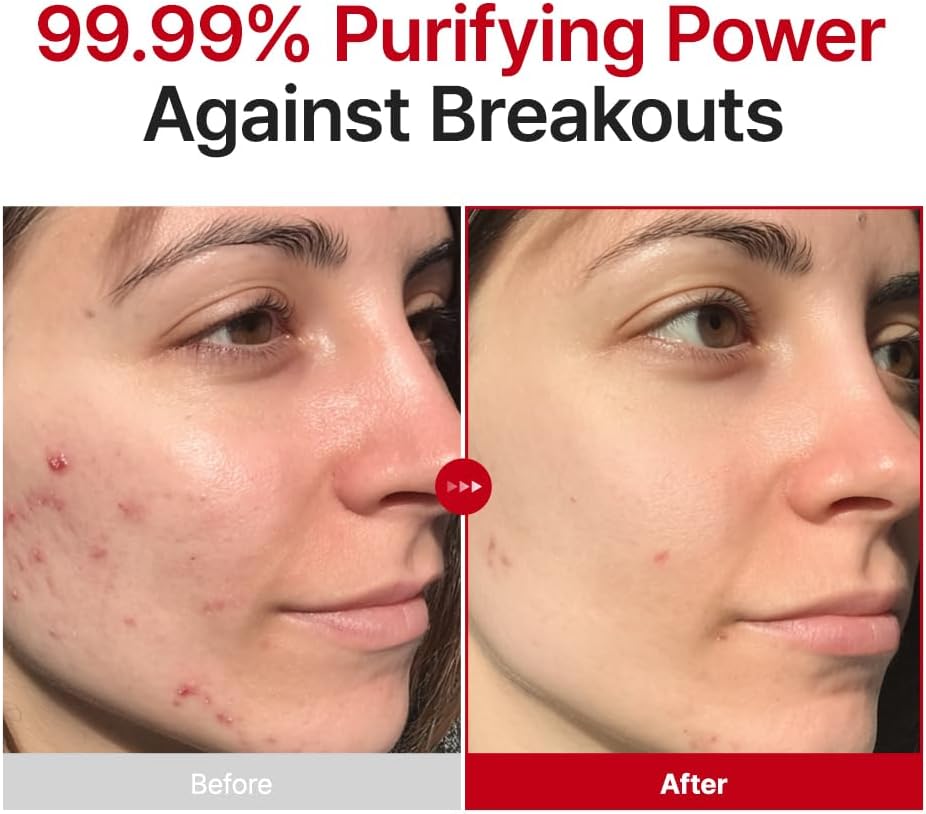 PURITO SEOUL Azelaic Acid 10% Kojic Tea Tree Serum 30ml | Brightening Blemish Serum