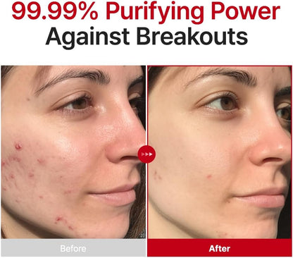 PURITO SEOUL Hypochlorous Acid Rescue Spray 100ml | Calming Blemish Mist
