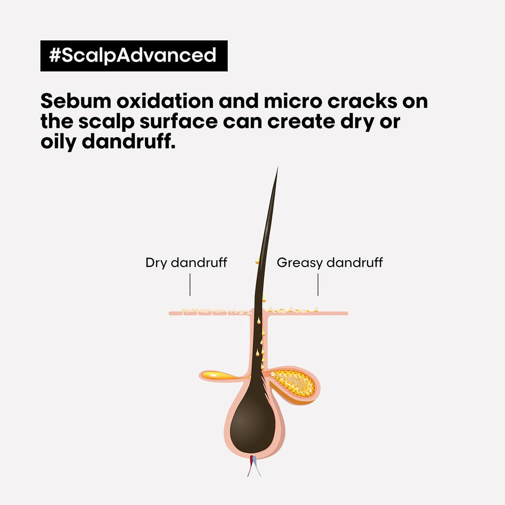 L'Oréal Professionnel Scalp Advanced Anti-Dandruff Shampoo 300ml – image 3