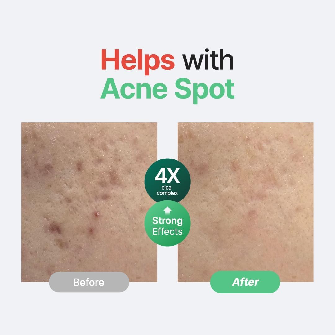 PURITO SEOUL Wonder Releaf Centella Serum Unscented 60ml | Barrier Repair Serum