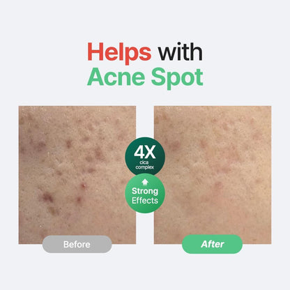 PURITO SEOUL Wonder Releaf Centella Serum Unscented 60ml | Barrier Repair Serum