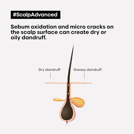 L'Oréal Professionnel Scalp Advanced Anti-Dandruff Shampoo 500ml – image 2