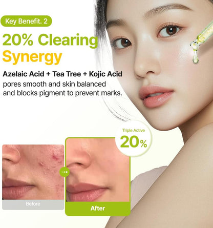 PURITO SEOUL Azelaic Acid 10% Kojic Tea Tree Serum 30ml | Brightening Blemish Serum