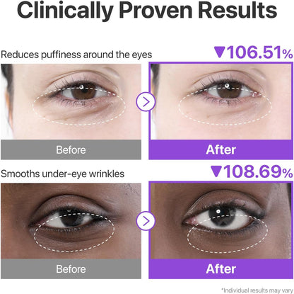 numbuzin No.9 NAD+ Collagen Under Eye Patches (5 Pairs)