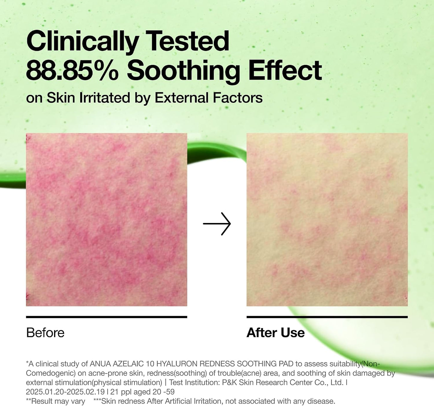 Anua Azelaic 10% Hyaluron Redness Soothing Pad (90 Pads)