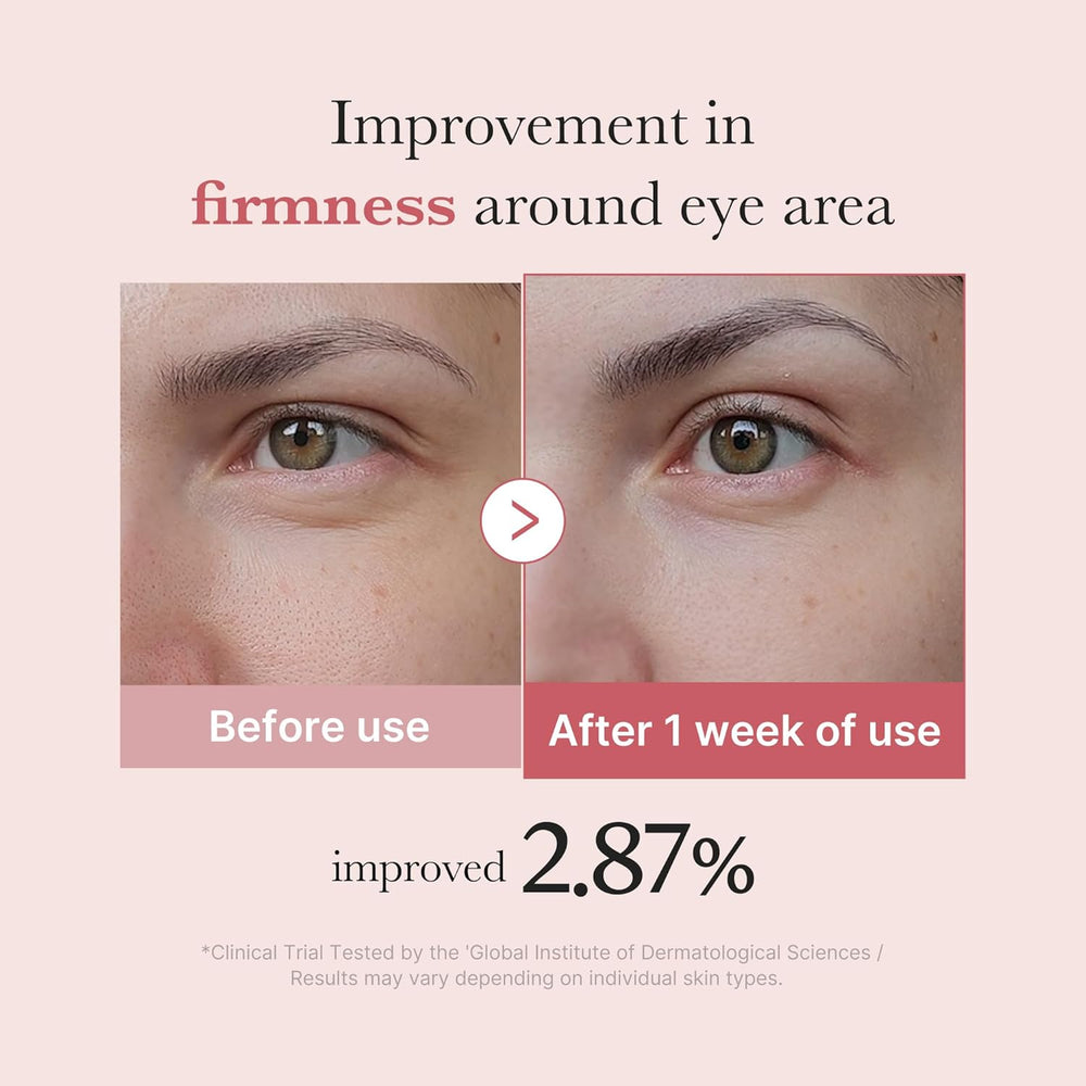 Medicube PDRN Pink Peptide Eye Cream (30ml)