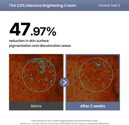 AXIS-Y TXA 2.5% Intensive Brightening Cream | Dark Spot & Post-Acne Mark Treatment