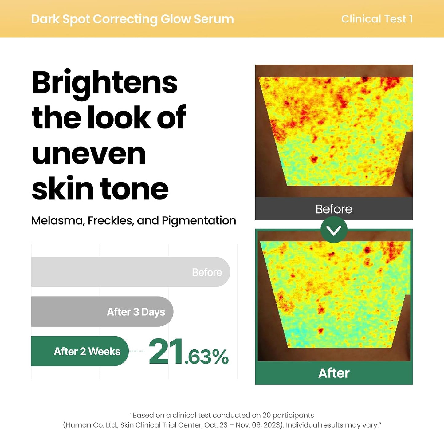 AXIS-Y Dark Spot Correcting Glow Serum 50ml | Niacinamide Brightening Serum for Dark Spots