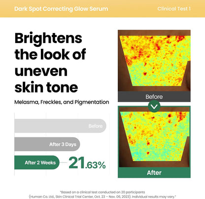 AXIS-Y Dark Spot Correcting Glow Serum 50ml | Niacinamide Brightening Serum for Dark Spots