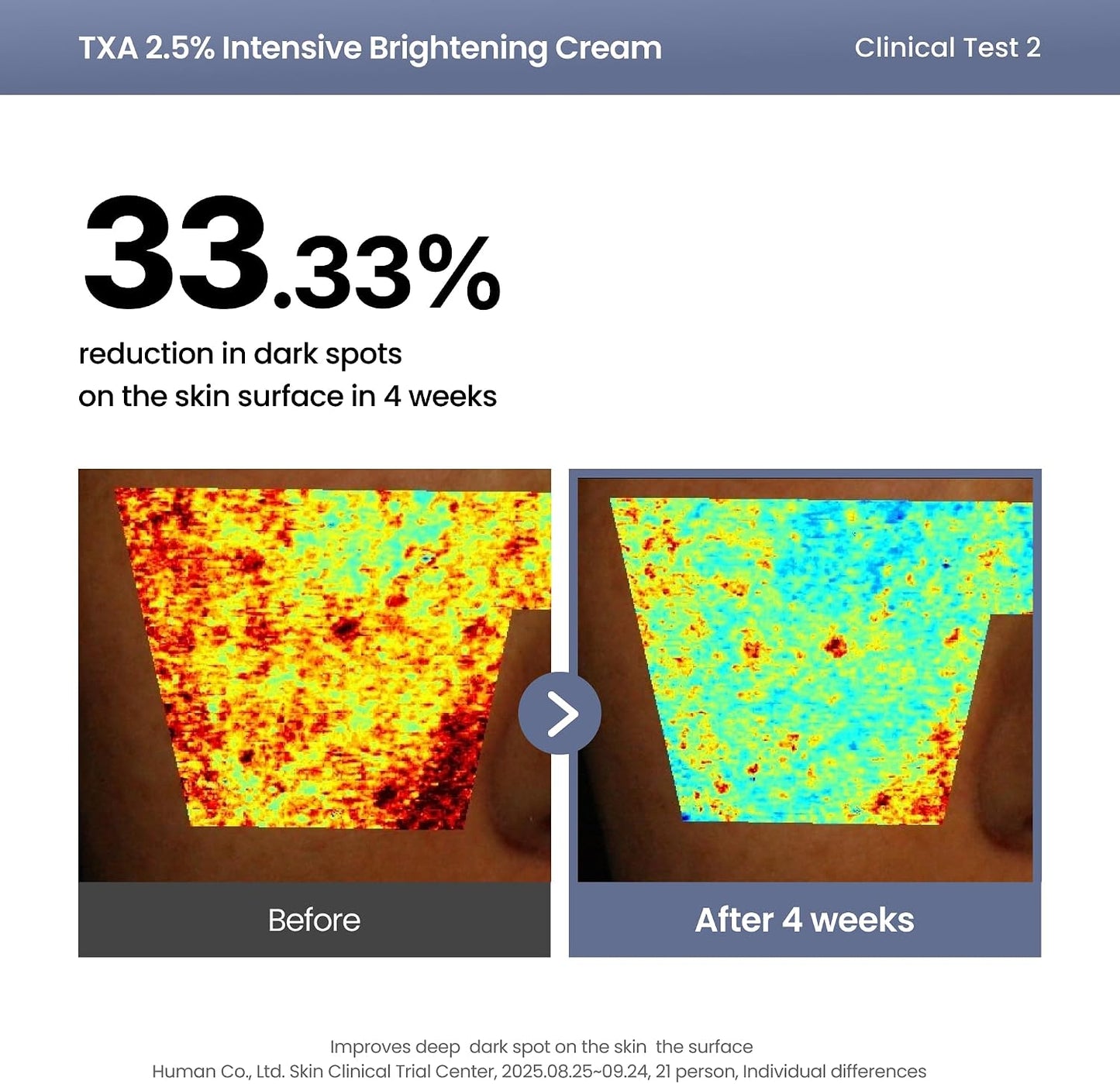AXIS-Y TXA 2.5% Intensive Brightening Cream | Dark Spot & Post-Acne Mark Treatment