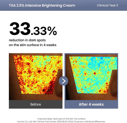 AXIS-Y TXA 2.5% Intensive Brightening Cream | Dark Spot & Post-Acne Mark Treatment