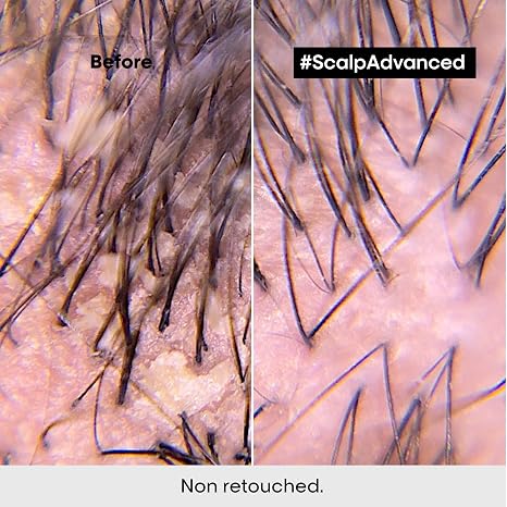 L'Oréal Professionnel Scalp Advanced Anti-Dandruff Shampoo 500ml – image 4