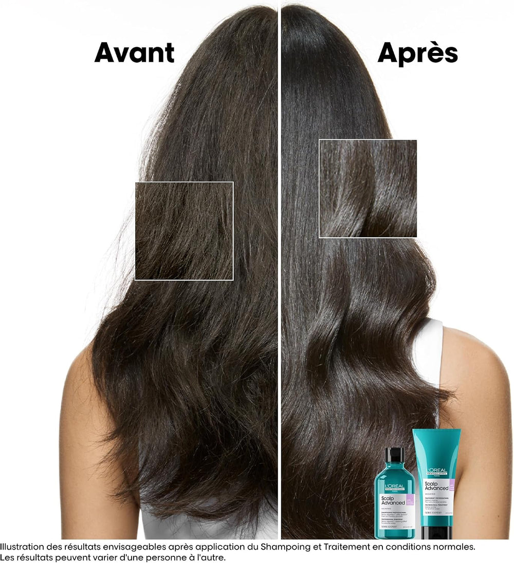 L'Oréal Professionnel Scalp Advanced Anti-Discomfort Shampoo 500ml – image 2