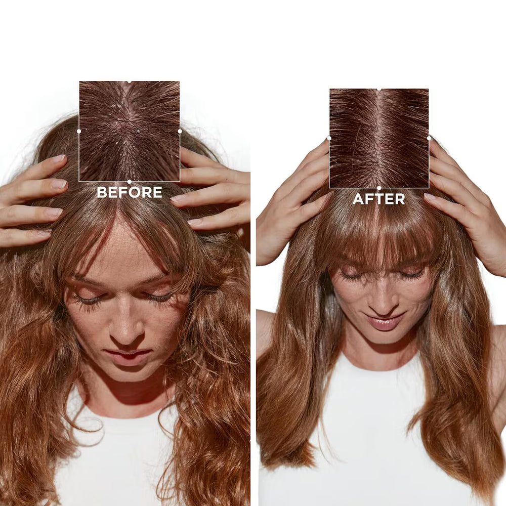 Kérastase Symbiose Bain Crème Anti-Pelliculaire Shampoo 250ml moisturising anti-dandruff shampoo – image 3