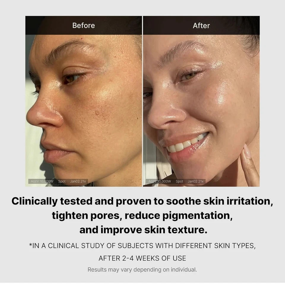 Before-and-after skincare comparison showing a woman's face with clearer, Medicube Triple Collagen Cream 50ml