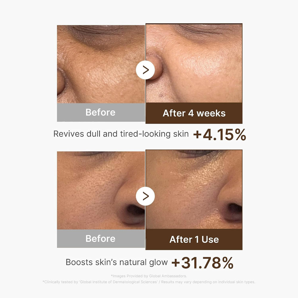 Before and after skin improvement results with percentages shown on a white background